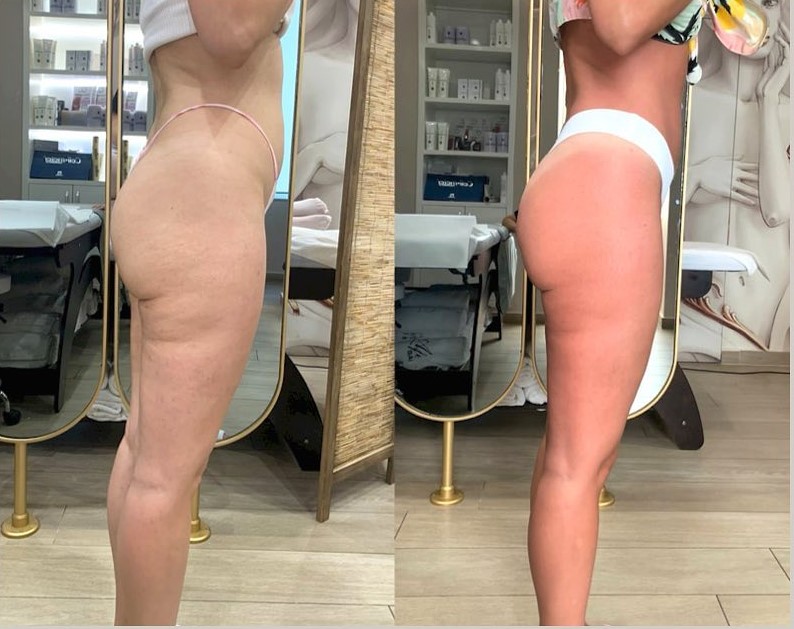 body-sculpt